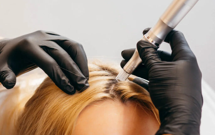 PRP Hair Restoration