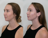 Facial Balancing