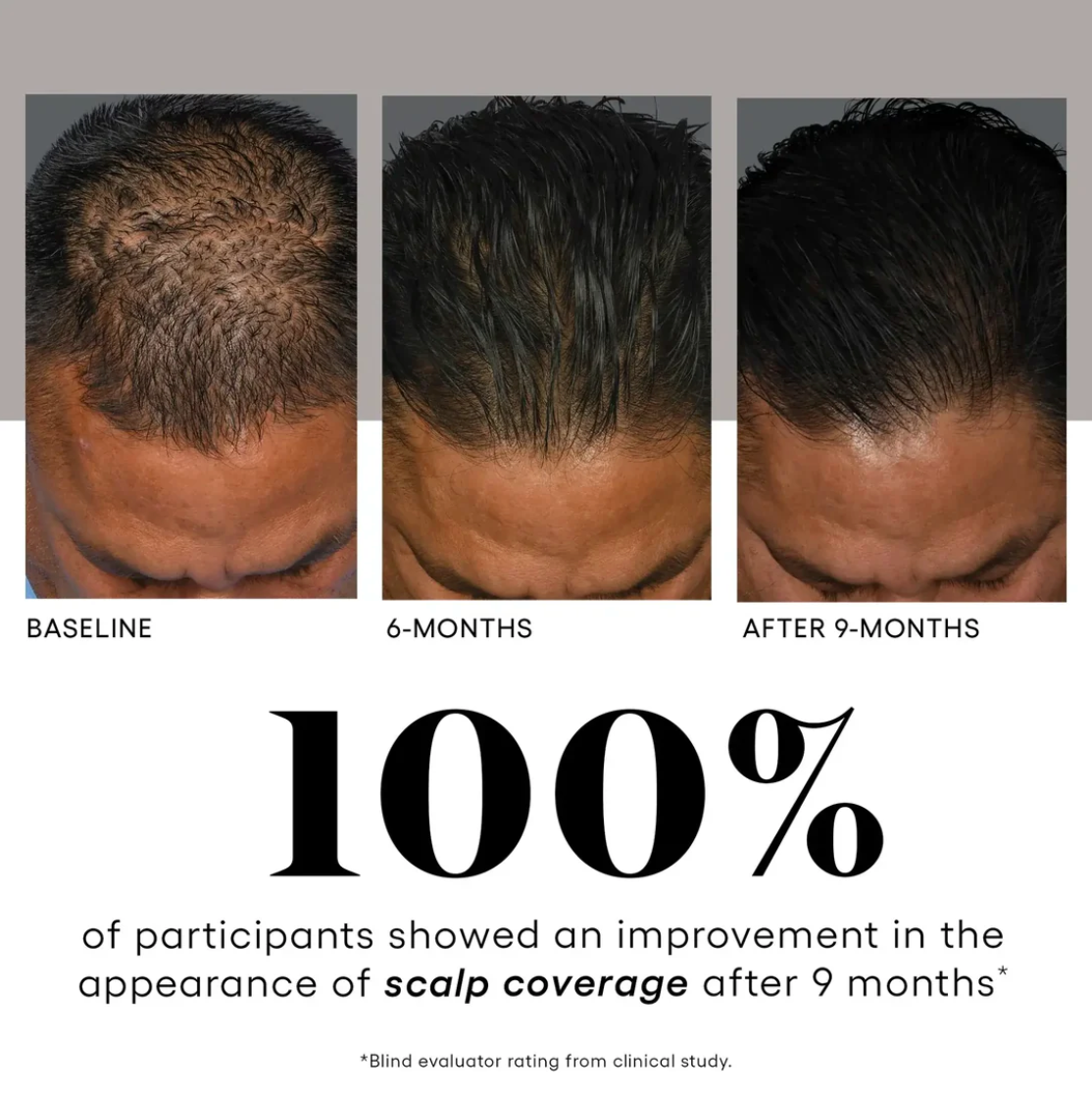 Plated Skincare - Hair Serum