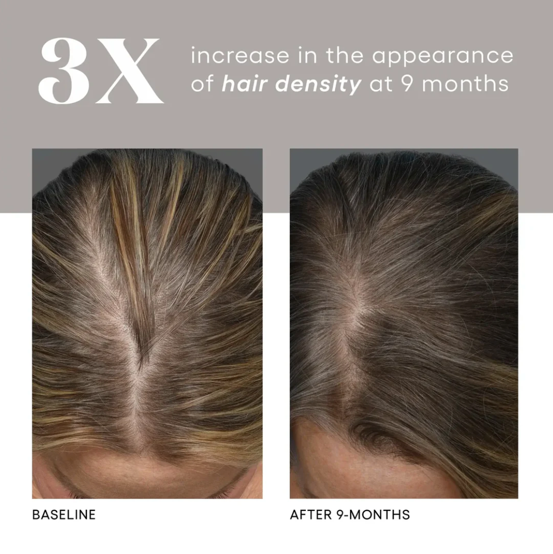 Plated Skincare - Hair Serum