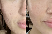 Skinvive