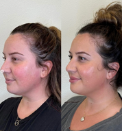 Facial Balancing