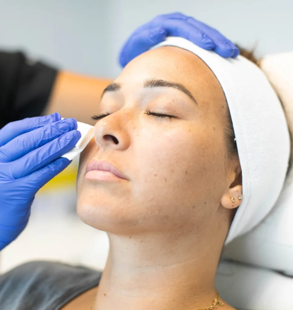 VI_Peel_-_Aloha_Med_Spa.webp